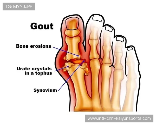 突尼斯希望中卫多次关键解围,尿酸700关节不疼还需要吃药吗 突尼斯希望中卫多次关键解围,尿酸700关节不疼还需要吃药吗